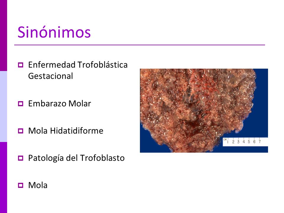 enfermedad trofoblastica gestacional